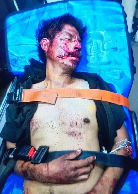 ATROPELLAN A HOMBRE EN LA COLONIA DEL EMPLEADO EN CUAUTLA; FAMILIARES YA FUERON NOTIFICADOS...👇