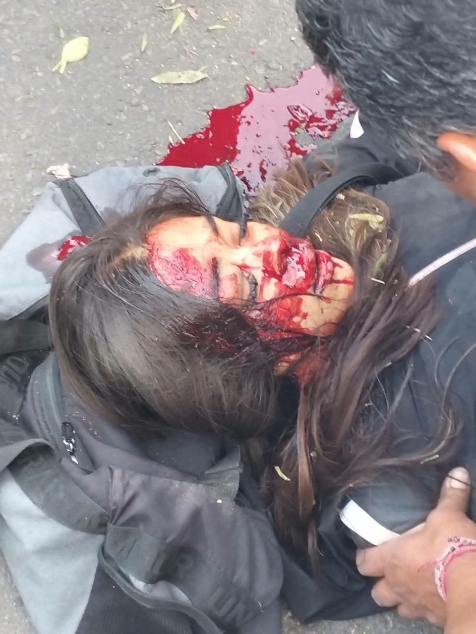 FUERTE ACCIDENTE DE UNA MUJER MOTOCICLISTA EN XOCHIMILCO...👇