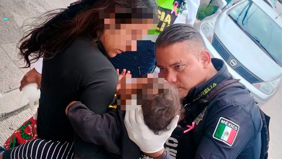 Bebé de apenas un año presentaba lesiones en el rostro; su madre solicitó auxilio a policías de Morelia